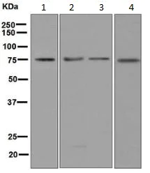 Western blot - Anti-ABI2 antibody [EPR7069] (AB133593)
