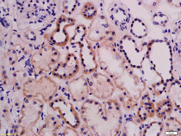Immunohistochemistry (Formalin/PFA-fixed paraffin-embedded sections) - Anti-ABI3 antibody (AB214318), expandable thumbnail