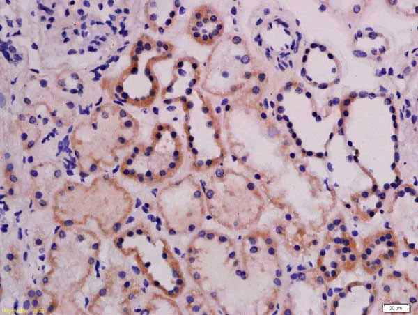 Immunohistochemistry (Formalin/PFA-fixed paraffin-embedded sections) - Anti-ABI3 antibody (AB214318)