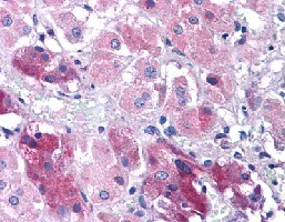 Immunohistochemistry (Formalin/PFA-fixed paraffin-embedded sections) - Anti-ABIN3 antibody (AB113748)
