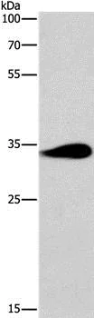 Western blot - Anti-ABIN3 antibody (AB198697)