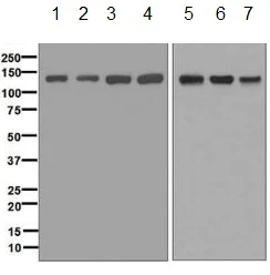 Western blot - Anti-ABL1 + ABL2 antibody [EPR1222(2)] (AB134134)