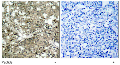 Immunohistochemistry (Formalin/PFA-fixed paraffin-embedded sections) - Anti-ABL1 antibody (AB47410)