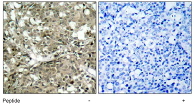 Immunohistochemistry (Formalin/PFA-fixed paraffin-embedded sections) - Anti-ABL1 antibody (AB47410)