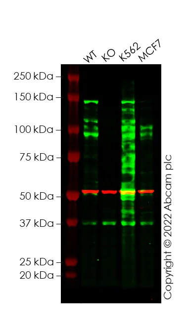 Western blot - Anti-ABL1 antibody [EPR23406-32] - BSA and Azide free (AB272701)