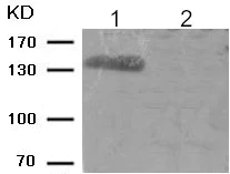 Western blot - Anti-ABL1 (phospho Y245) antibody (AB193223)