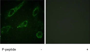Immunocytochemistry/ Immunofluorescence - Anti-ABL1 (phospho Y245) antibody (AB62189)