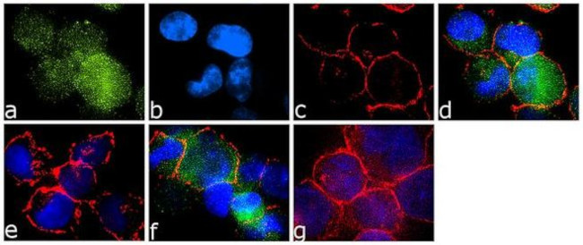 Immunocytochemistry/ Immunofluorescence - Anti-ABL1 (phospho Y393) Antibody [RP23040183] (AB313473), expandable thumbnail
