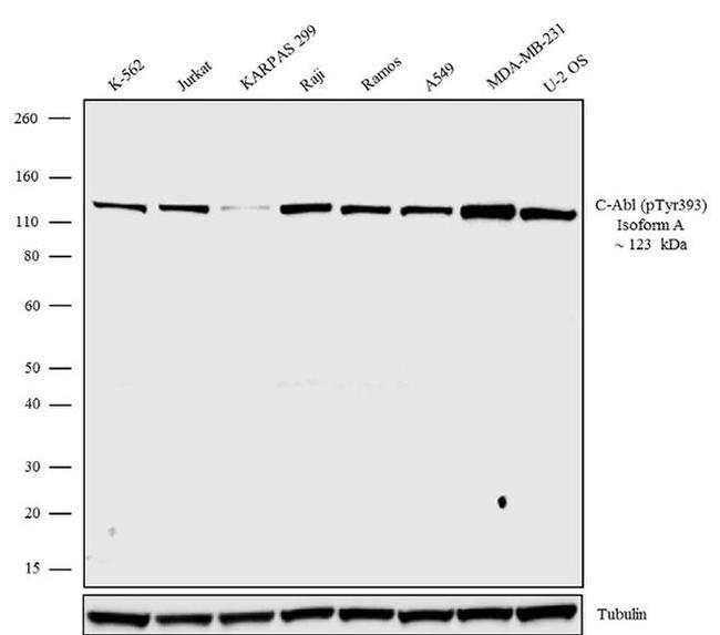 Western blot - Anti-ABL1 (phospho Y393) Antibody [RP23040183] (AB313473), expandable thumbnail