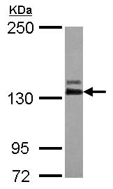Western blot - Anti-ABL2 antibody (AB126256), expandable thumbnail