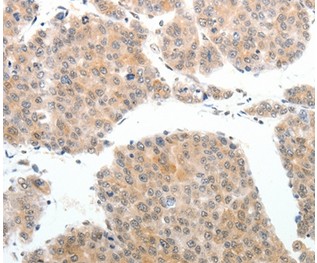 Immunohistochemistry (Formalin/PFA-fixed paraffin-embedded sections) - Anti-ABL2 antibody - N-terminal (AB198718)