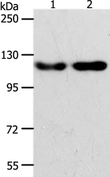 Western blot - Anti-ABL2 antibody - N-terminal (AB198718)