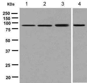 Western blot - Anti-ABLIM1 antibody [EPR9508] (AB140625)