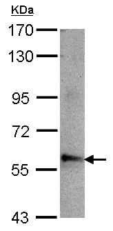 Western blot - Anti-ABLIM3 antibody (AB153804)