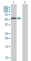 Western blot - Anti-ABLIM3 antibody (AB67721), expandable thumbnail