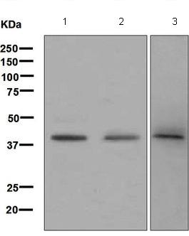 Western blot - Anti-ABO antibody [EPR6205] (AB126612), expandable thumbnail