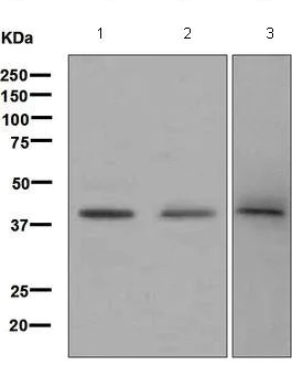 Western blot - Anti-ABO antibody [EPR6205] (AB126612)