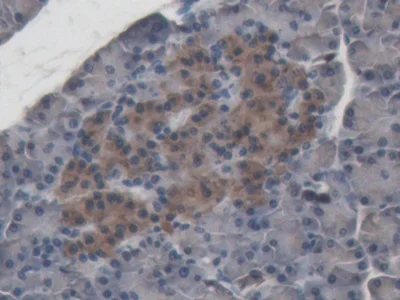 Immunohistochemistry (Formalin/PFA-fixed paraffin-embedded sections) - Anti-ABP1 antibody (AB231147)