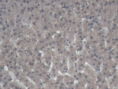 Immunohistochemistry (Formalin/PFA-fixed paraffin-embedded sections) - Anti-ABP1 antibody (AB231147)