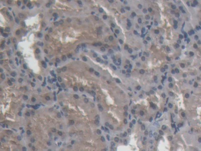 Immunohistochemistry (Formalin/PFA-fixed paraffin-embedded sections) - Anti-ABP1 antibody (AB231147)