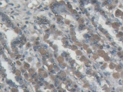 Immunohistochemistry (Formalin/PFA-fixed paraffin-embedded sections) - Anti-ABP1 antibody (AB231147)