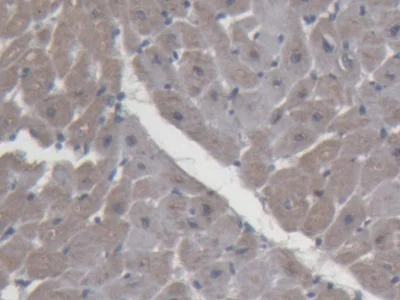 Immunohistochemistry (Formalin/PFA-fixed paraffin-embedded sections) - Anti-ABP1 antibody (AB231147)