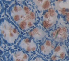 Immunohistochemistry (Formalin/PFA-fixed paraffin-embedded sections) - Anti-ABP1 antibody (AB231541)