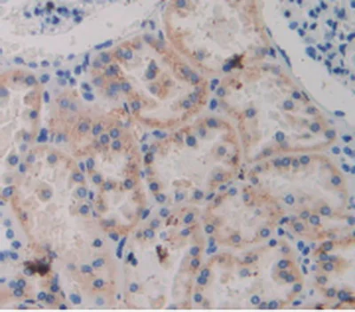 Anti-ABP1 antibody (ab231558) | Abcam