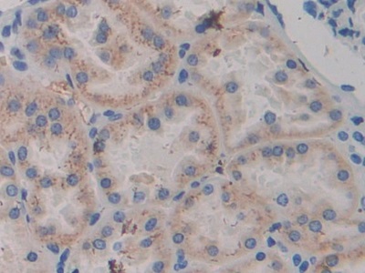 Immunohistochemistry (Formalin/PFA-fixed paraffin-embedded sections) - Anti-ABP1 antibody (AB231558), expandable thumbnail