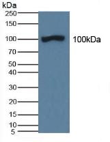 Western blot - Anti-ABP1 antibody (AB231558), expandable thumbnail