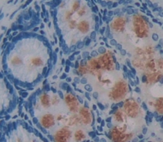 Immunohistochemistry (Formalin/PFA-fixed paraffin-embedded sections) - Anti-ABP1 antibody (AB231605), expandable thumbnail