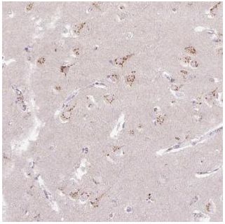 Immunohistochemistry (Formalin/PFA-fixed paraffin-embedded sections) - Anti-ABR antibody (AB188071)