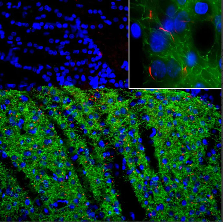 Immunohistochemistry - Anti-AC3 antibody [1A12] (AB277619)