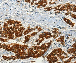 Immunohistochemistry (Formalin/PFA-fixed paraffin-embedded sections) - Anti-AC3 antibody - C-terminal (AB199157)