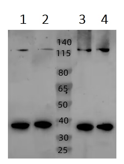 Western blot - Anti-AC3 antibody - C-terminal (AB199157)