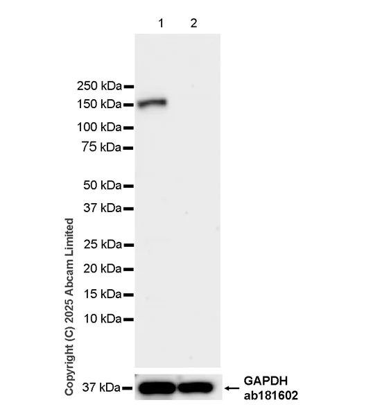 Western blot - Anti-AC3 antibody [EPR28777-12] (AB323453)