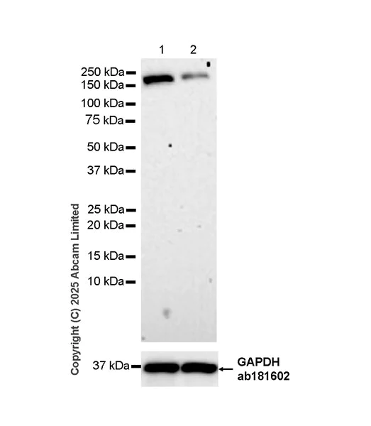 Western blot - Anti-AC3 antibody [EPR28777-12] (AB323453)