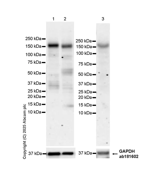 Western blot - Anti-AC3 antibody [EPR28777-12] (AB323453)