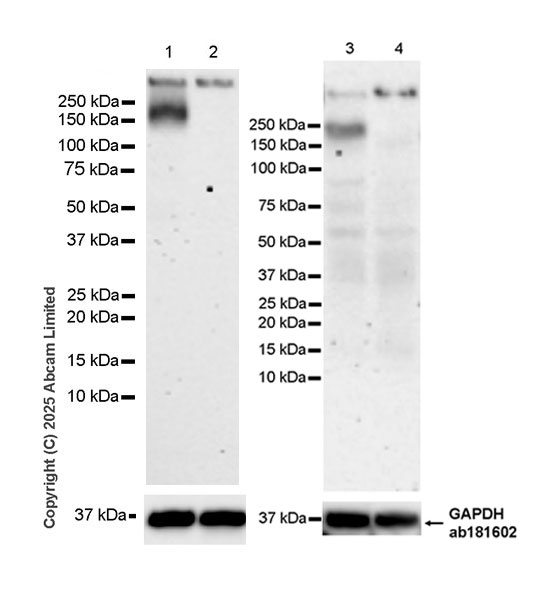 Western blot - Anti-AC3 antibody [EPR28777-12] (AB323453), expandable thumbnail