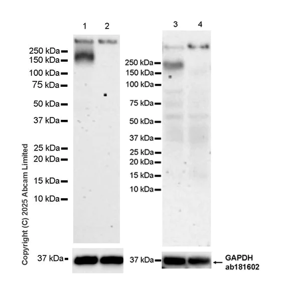 Western blot - Anti-AC3 antibody [EPR28777-12] (AB323453)