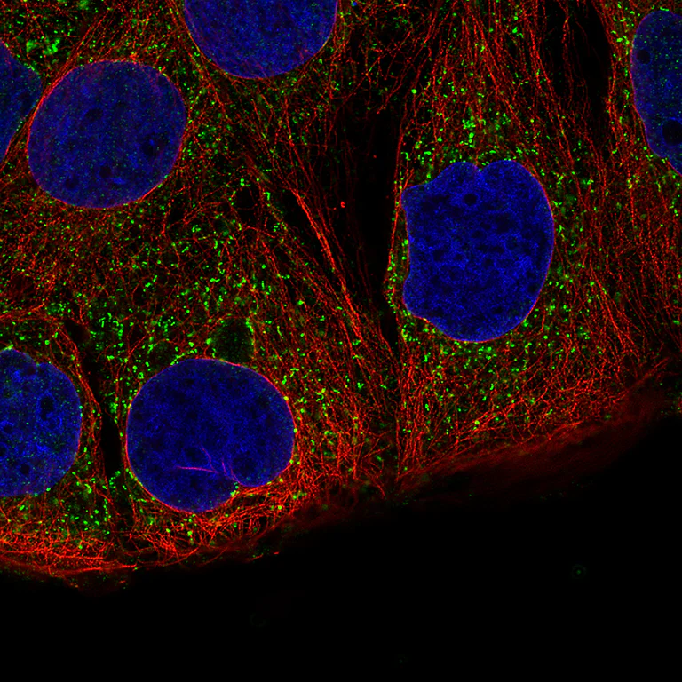 Immunocytochemistry/ Immunofluorescence - Anti-ACAA1 Antibody [CL2660] (AB327110)