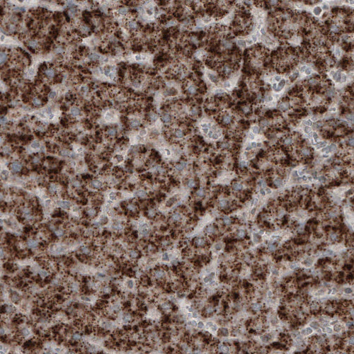 Immunohistochemistry (Formalin/PFA-fixed paraffin-embedded sections) - Anti-ACAA1 Antibody [CL2660] (AB327110)