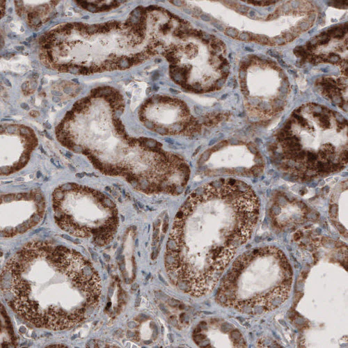 Immunohistochemistry (Formalin/PFA-fixed paraffin-embedded sections) - Anti-ACAA1 Antibody [CL2660] (AB327110)