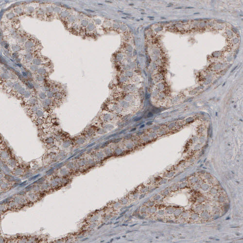 Immunohistochemistry (Formalin/PFA-fixed paraffin-embedded sections) - Anti-ACAA1 Antibody [CL2660] (AB327110)