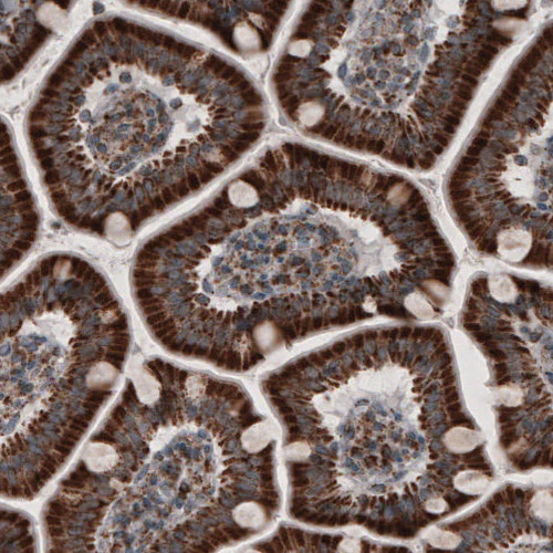 Immunohistochemistry (Formalin/PFA-fixed paraffin-embedded sections) - Anti-ACAA1 Antibody [CL2660] (AB327110)