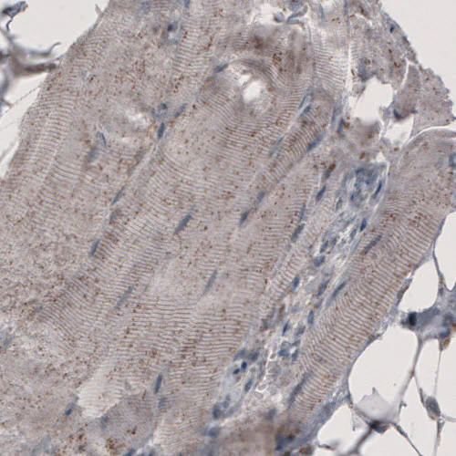 Immunohistochemistry (Formalin/PFA-fixed paraffin-embedded sections) - Anti-ACAA1 Antibody [CL2660] (AB327110)