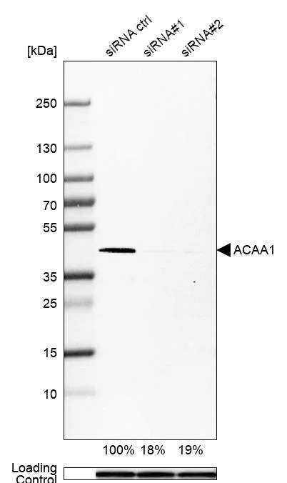 Western blot - Anti-ACAA1 Antibody [CL2660] (AB327110)