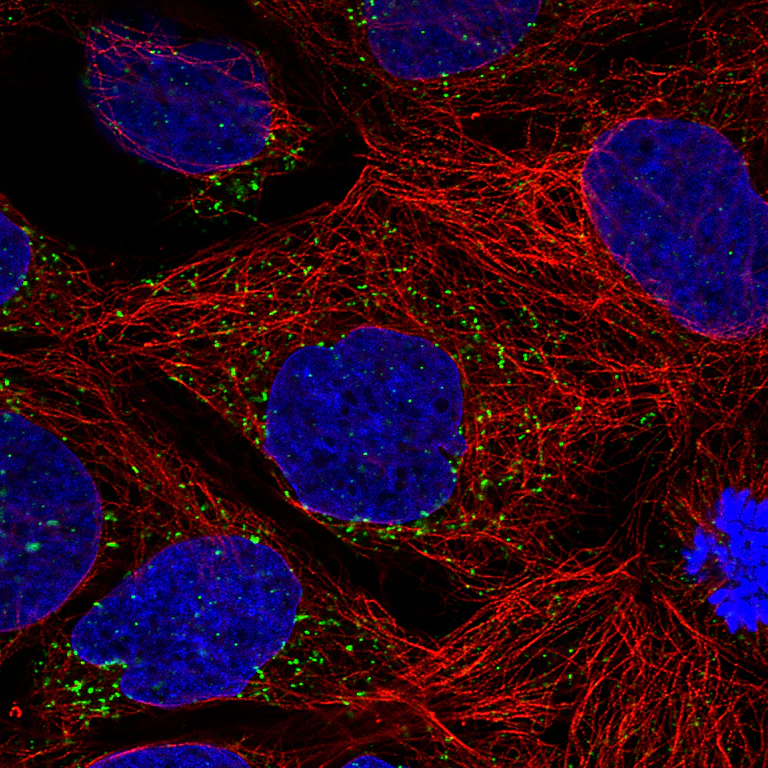 Immunocytochemistry/ Immunofluorescence - Anti-ACAA1 Antibody [CL2662] (AB327108)