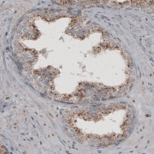 Immunohistochemistry (Formalin/PFA-fixed paraffin-embedded sections) - Anti-ACAA1 Antibody [CL2662] (AB327108)
