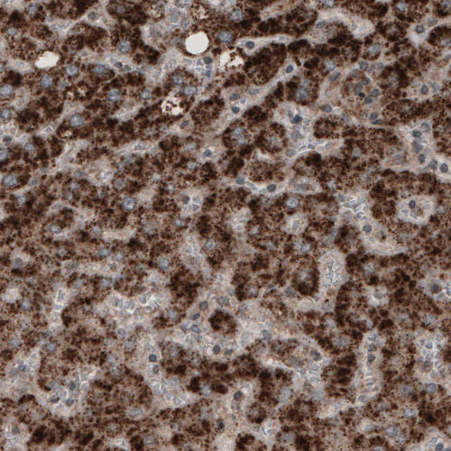 Immunohistochemistry (Formalin/PFA-fixed paraffin-embedded sections) - Anti-ACAA1 Antibody [CL2662] (AB327108)